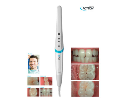 Intraorální kamera Acteon Satelec C50-00 Full HD kamera