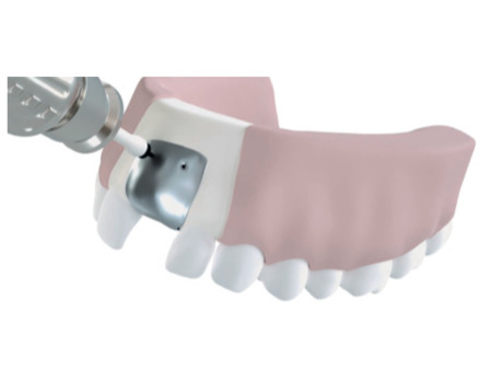 Botiss NOVAMag® - resorbovatelná membrána XS – 10 x 20 mm (721020)