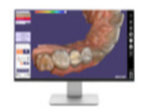 Exocad CAD/CAM software