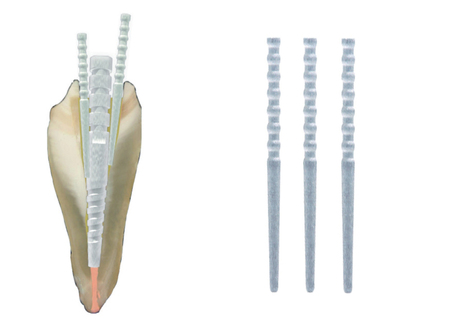 Fibrecone post DT Light vyztužovací čepy 20ks/bal