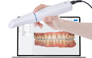 CAD/CAM intraorální skenery