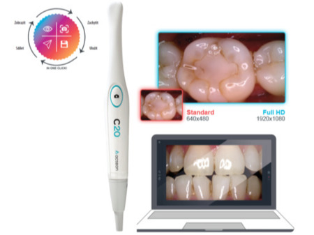 Intraorální kamera Acteon Satelec C20 Full HD kamera
