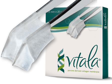 Vitala® 20 mm x 30 mm extra tenká Porcine Pericardium Collagen Membrane