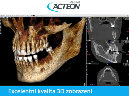 Acteon Satelec CBCT X-Mind PRIME 3D PAN CBCT basic