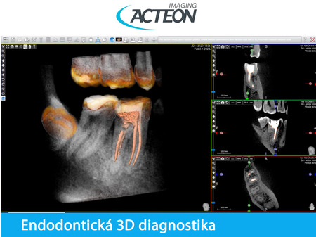 Acteon Satelec CBCT X-Mind PRIME wall 3D PAN CBCT basic 