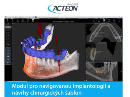Acteon Satelec CBCT X-Mind Trium 3D PAN